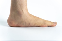 Causes and Symptoms of Painful Flat Feet Explained
