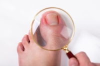 When a Curled Toenail Grows Into the Skin
