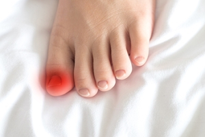 What Causes an Ingrown Toenail?