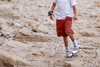 Recognizing Clubfoot Symptoms and the Importance of Early Diagnosis