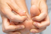 Signs You May Have Athlete&rsquo;s Foot